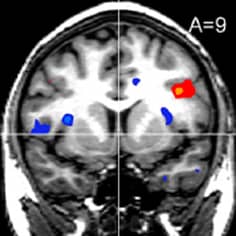 fMRI Brain scan 